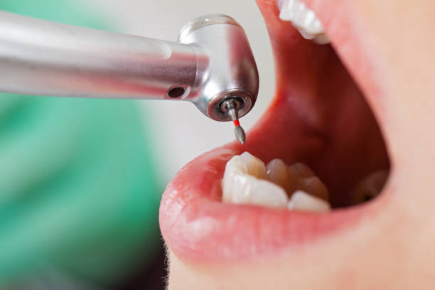 Best Emergency Treatment for Jaw Pain or Injury in Monroeville, OH
